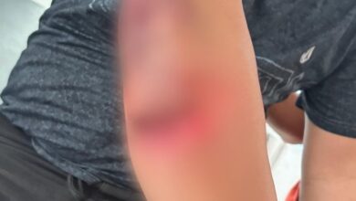 Polres Morowali: Penangkapan Pelaku Pembakaran PT RCP Sesuai Prosedur, 1 Polisi Terluka Parah 19 Jahitan 