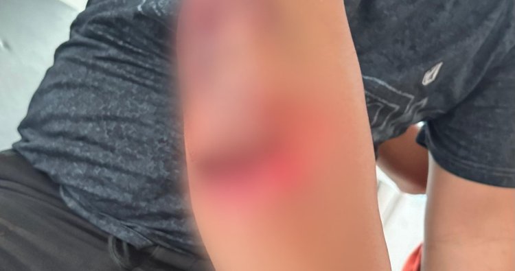 Polres Morowali: Penangkapan Pelaku Pembakaran PT RCP Sesuai Prosedur, 1 Polisi Terluka Parah 19 Jahitan 